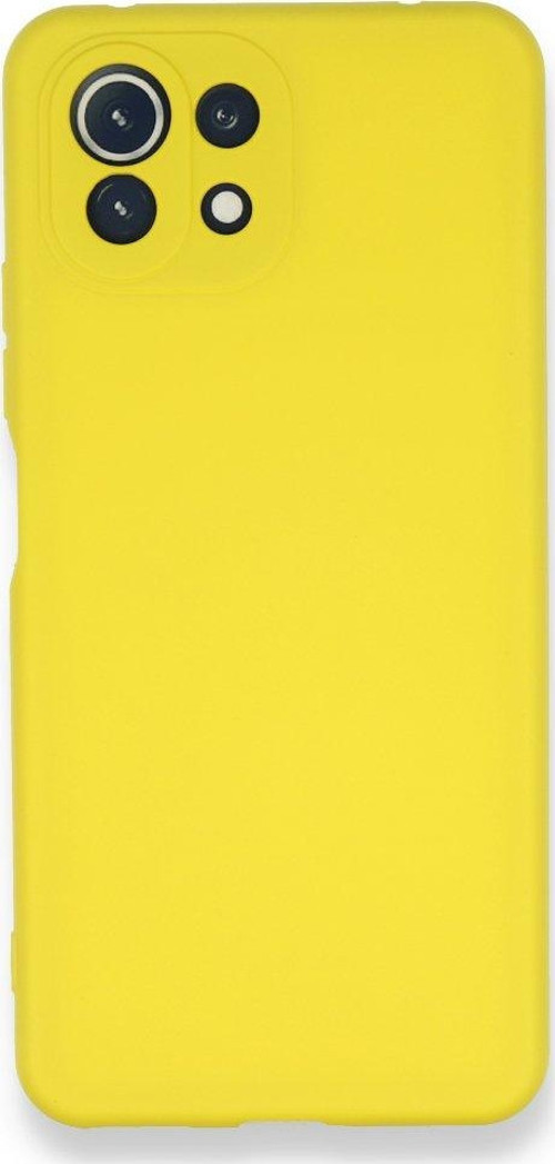 Xiaomi Mi 11 Lite Kılıf Nano İçi Kadife Silikon