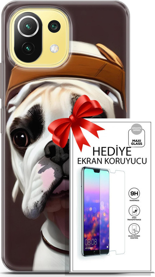 Xiaomi 11 Lite 5G Kılıf Orijinal Seri Dogs 26 Mastiff Soft Kapak + Ekran Koruyucu