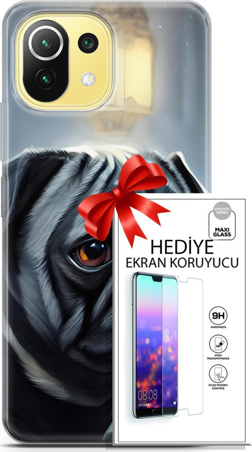 Xiaomi 11 Lite 5G Kılıf Orijinal Seri Dogs 30 Pug Kenarları Şeffaf Kapak Ve Ekran Koruyucu