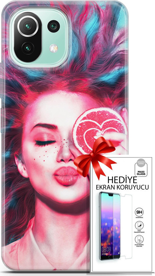 Xiaomi 11 Lite 5G Ne Kılıf Orijinal Seri Algorand 08 Greyfurt Baskılı Kılıf + Ekran Koruyucu