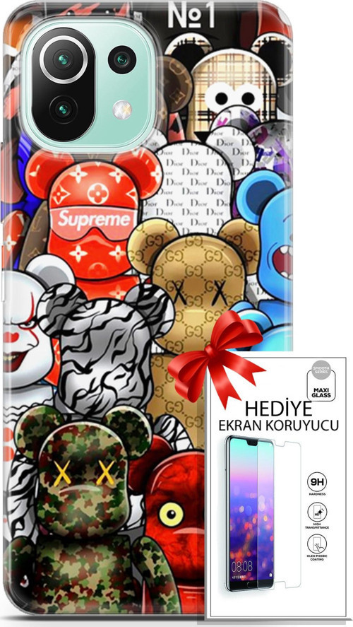Xiaomi 11 Lite 5G Ne Kılıf Orijinal Seri Bounce 13 Louisa Burke Case Kapak Ekran Koruyucu