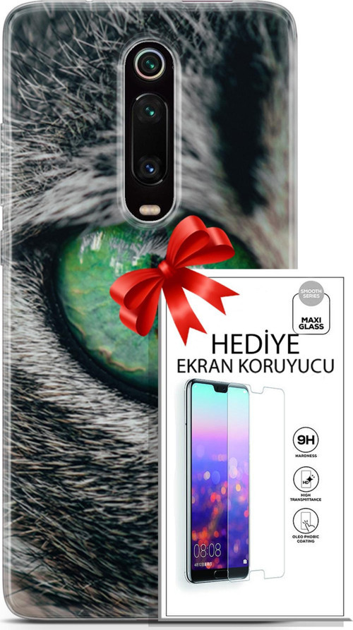 Xiaomi Mi 9T Kılıf Orijinal Seri Scotish-British 28 Göz Detay İz Bırakmayan Kılıf + Ön Ekran Koruyucu