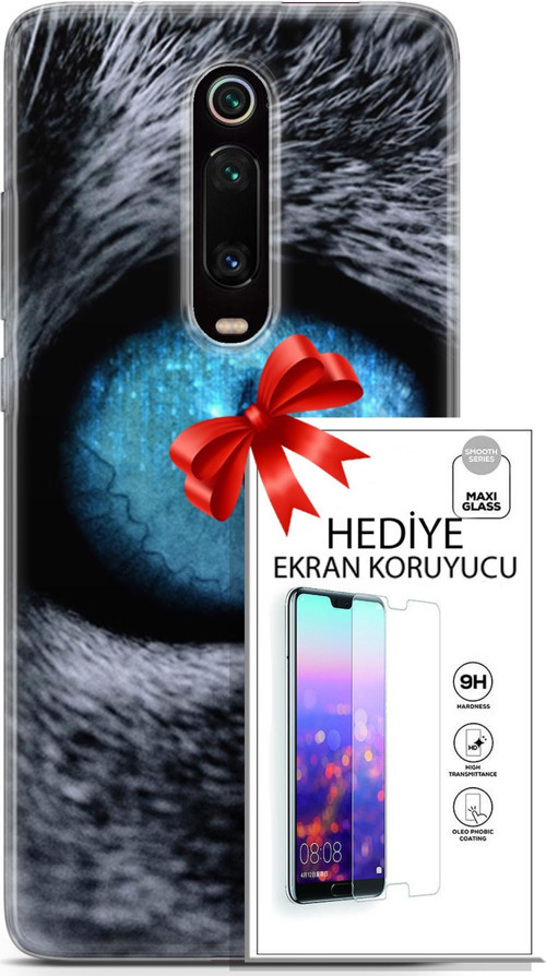 Xiaomi Mi 9T Kılıf Orijinal Seri Scotish-British 29 Pov Eye Leke Tutmaz Kapak + Ekran Koruyucu