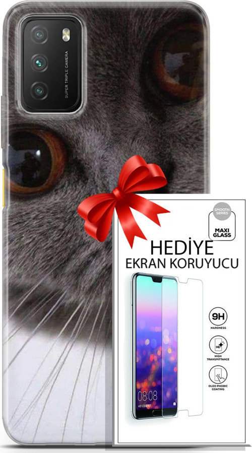 Xiaomi Poco M3 Kılıf Orijinal Seri Scotish-British 11 Pov British 4K Baskılı Kılıf + Ekran Koruyucu